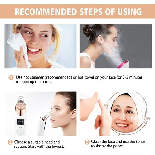 Revolutionary Blackhead Remover Vacuum: USB Rechargeable Facial Pore Cleaner for Spotless Skin